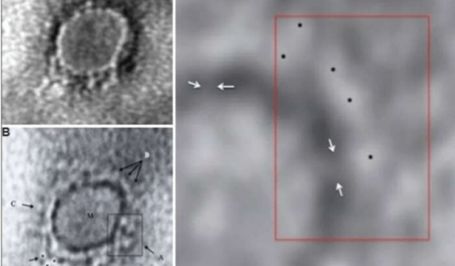 First Electron Microscope Image Of COVID-19 Virus From India Released