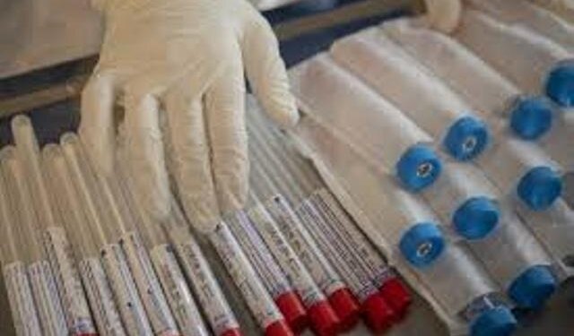 China dispatches 650,000 medical kits to India to fight COVID-19: Indian envoy