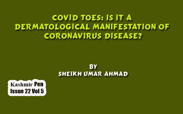 COVID Toes: Is It A  Dermatological  Manifestation Of  Coronavirus Disease?