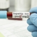 Kulgam village reports Hepatitis case, one dead, another hospitalised