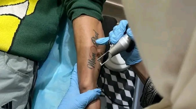 Free Tattoo Removal Camp by Ehsaas Foundation and Revive Aesthetics Concludes Successfully in Srinagar
