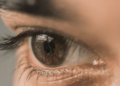 5 Silent Symptoms Of Fatty Liver Disease You Can Easily Spot Just By Looking At Your Eyes